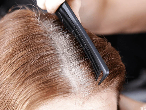 Tight scalp